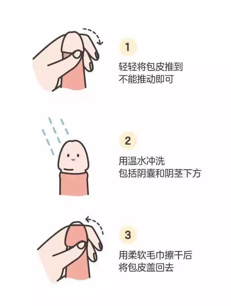 包皮割不割是个大问题,美中帮您解决