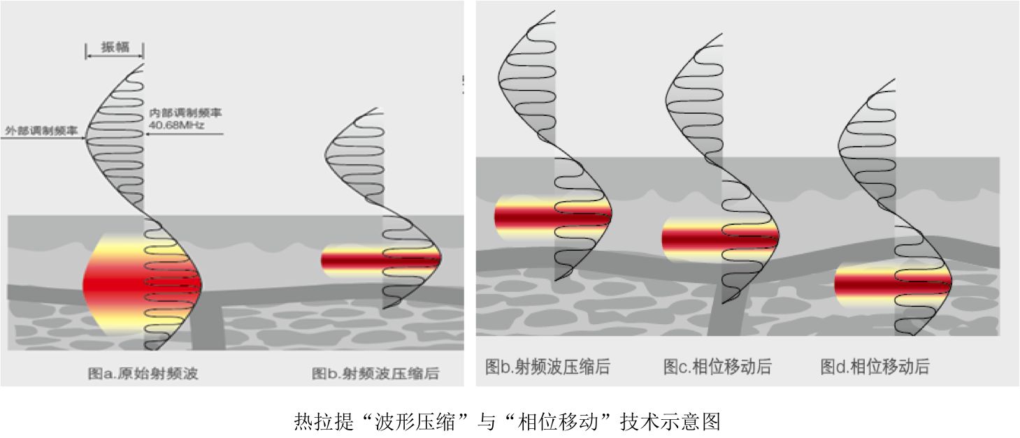 射频的频率:4068mhz,射频波每秒钟交变4000万次